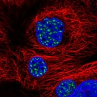 Immunofluorescent staining of human cell line A-431 shows localization to nuclear speckles.