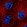 Anti-SON Antibody
