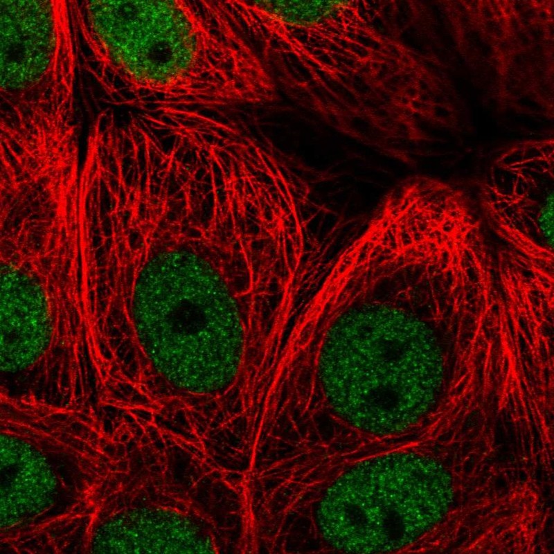 Anti-ZBTB21 Antibody