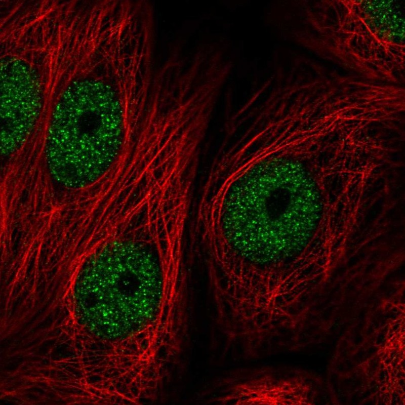 Anti-ZBTB21 Antibody