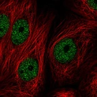 Anti-ZBTB21 Antibody