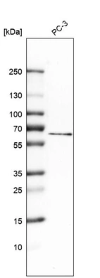 Anti-MCOLN1 Antibody