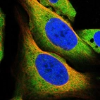 Immunofluorescent staining of human cell line U-2 OS shows localization to plasma membrane & cytosol.