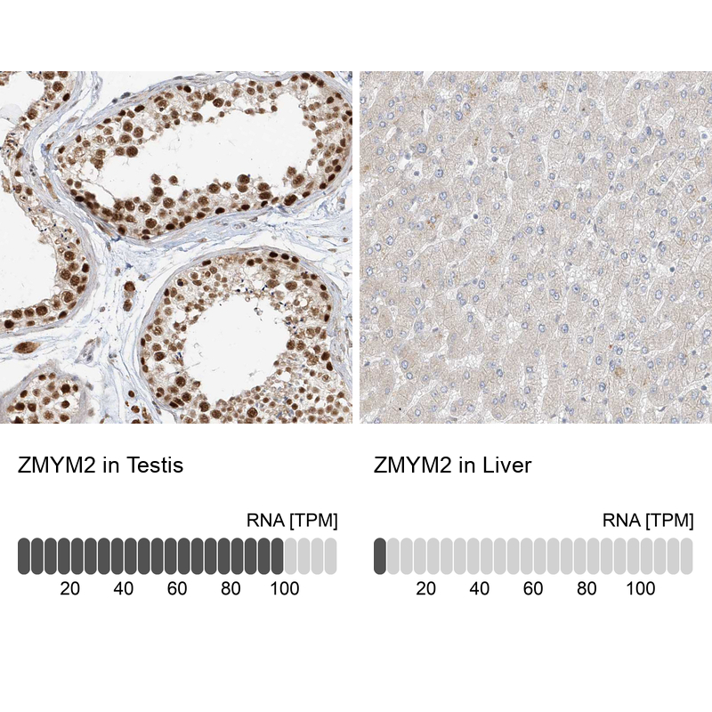 Anti-ZMYM2 Antibody