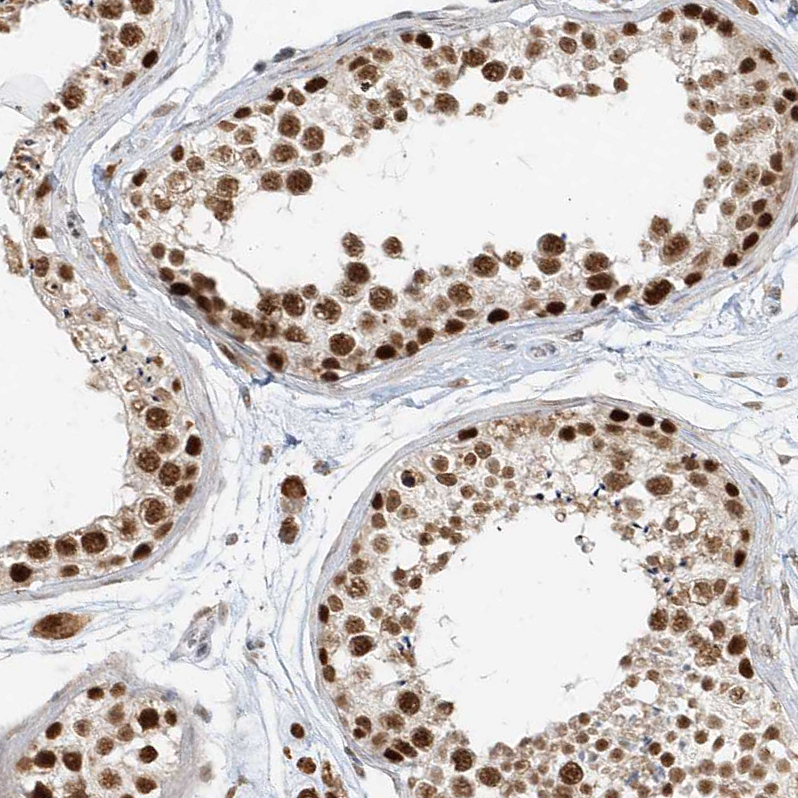 Anti-ZMYM2 Antibody