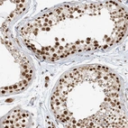 Anti-ZMYM2 Antibody