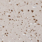 Immunohistochemical staining of human cerebral cortex shows strong nuclear/cytoplasmic positivity in neurons and weak cytoplasmic positivity in neuropil.
