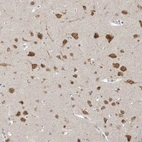 Immunohistochemical staining of human cerebral cortex shows strong nuclear/cytoplasmic positivity in neurons and weak cytoplasmic positivity in neuropil.