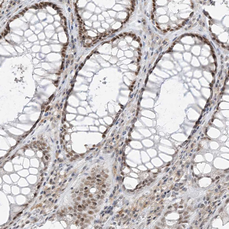 Rabbit Polyclonal Anti-ZMYM2 Antibody - Buy for research - Highly ...