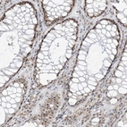 Immunohistochemical staining of human gastrointestinal shows strong nuclear-cytoplasmic positivity in glandular cells.