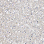 Immunohistochemical staining of human liver shows weak cytoplasmic positivity in hepatocytes.