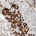 Anti-ZBTB8A Antibody