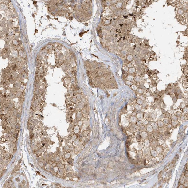 Anti-ZBTB8A Antibody