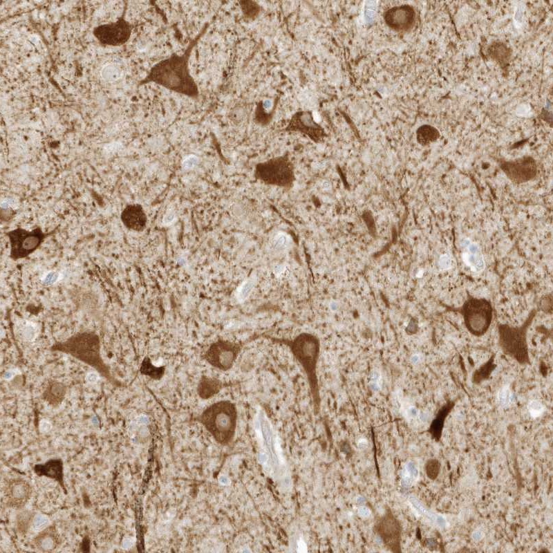 Anti-ZBTB8A Antibody