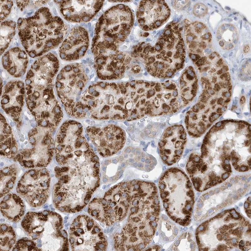 Anti-ATP13A5 Antibody