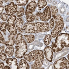 Anti-ATP13A5 Antibody