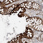 Anti-BCORL1 Antibody