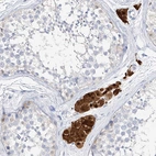 Anti-ZZEF1 Antibody