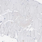 Immunohistochemical staining of human skeletal muscle shows no positivity in myocytes.