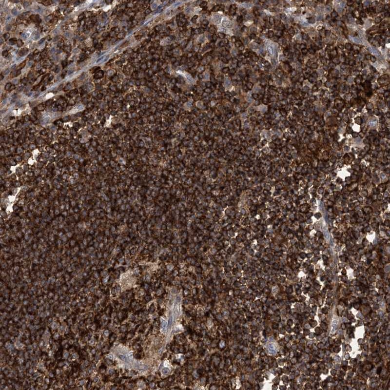 Anti-AK9 Antibody