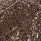 Anti-AK9 Antibody