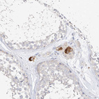 Anti-ZZEF1 Antibody