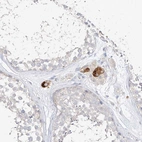 Anti-ZZEF1 Antibody