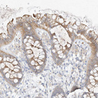 Immunohistochemical staining of human colon shows moderate to strong cytoplasmic positivity in glandular cells.
