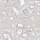 Immunohistochemical staining of human kidney shows moderate to strong cytoplasmic positivity in cells in tubules.