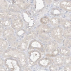 Immunohistochemical staining of human kidney shows moderate to strong cytoplasmic positivity in cells in tubules.