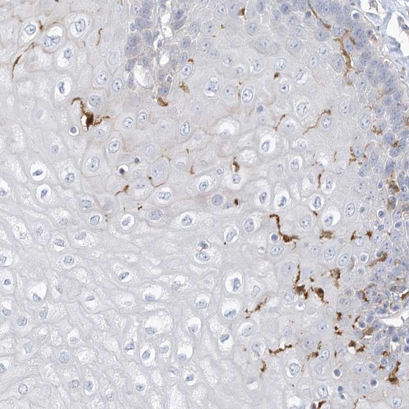 Anti-ATP13A1 Antibody
