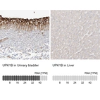 Anti-UPK1B Antibody