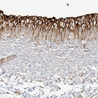 Immunohistochemical staining of human urinary bladder shows strong membranous positivity in urothelial cells.