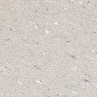 Immunohistochemical staining of human cerebral cortex shows no positivity in neurons as expected.