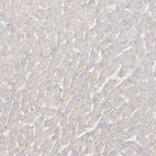 Immunohistochemical staining of human liver shows no positivity in hepatocytes as expected.