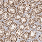 Immunohistochemical staining of human stomach shows moderate membranous positivity in glandular cells.