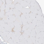 Immunohistochemical staining of human skeletal muscle shows no positivity in myocytes as expected.