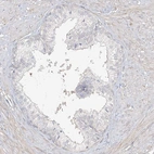 Immunohistochemical staining of human prostate shows no positivity in glandular cells as expected.