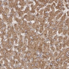 Immunohistochemical staining of human liver shows moderate cytoplasmic positivity in hepatocytes.