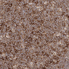 Immunohistochemical staining of human tonsil tissue shows strong cytoplasmic membranous positivity in germinal center cells.