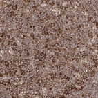 Immunohistochemical staining of human tonsil tissue shows strong cytoplasmic membranous positivity in germinal center cells.