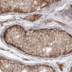 Immunohistochemical staining of human testis shows strong cytoplasmic membranous positivity in cells in seminiferous ducts and leydig cells.