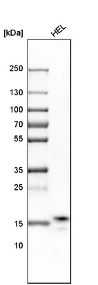 Western blot analysis in human cell line HEL.