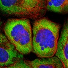 Immunofluorescent staining of human cell line A-431 shows localization to cytosol & endoplasmic reticulum.