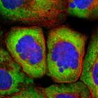 Immunofluorescent staining of human cell line A-431 shows localization to cytosol & endoplasmic reticulum.