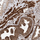 Anti-LATS1 Antibody
