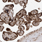 Immunohistochemical staining of human placenta shows strong cytoplasmic positivity in trophoblastic cells.