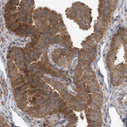 Immunohistochemical staining of human fallopian tube shows moderate cytoplasmic positivity in glandular cells.