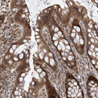 Immunohistochemical staining of human rectum shows moderate cytoplasmic positivity in glandular cells.