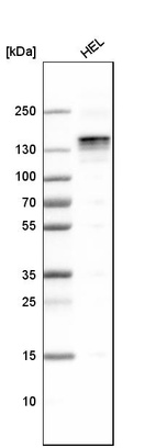 Western blot analysis in human cell line HEL.